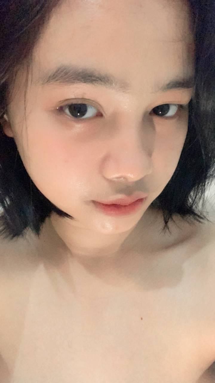 41