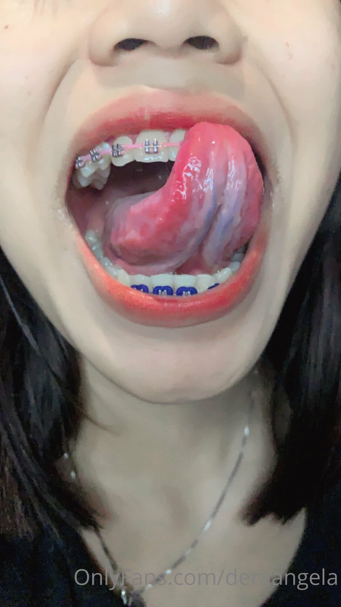 dera35